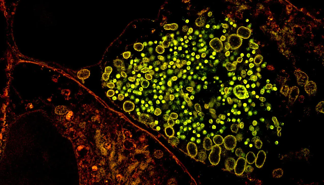 Chlamydia Uses Lipid Coats To Protect Its DNA From Host Defenses