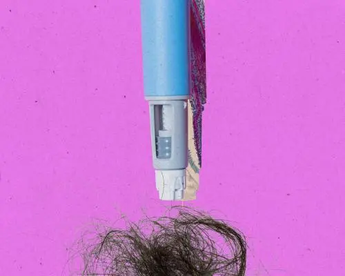 GLP‑1 Drugs and Sudden Hair Loss: What Patients Need to Know